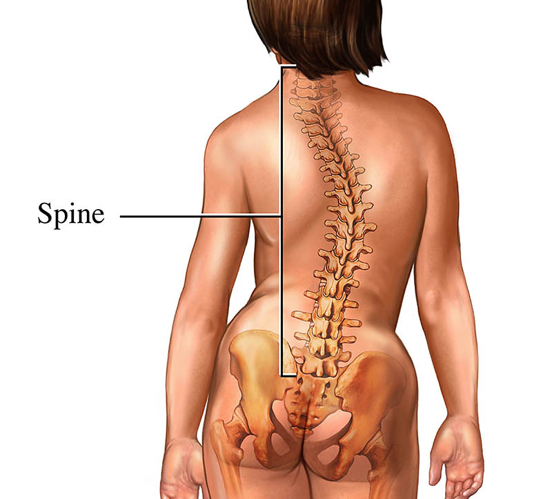 Scoliosis screening and treatment