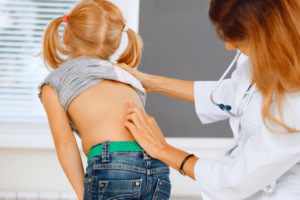 Read more about the article Empowering Health: Early Scoliosis Screening and Treatment